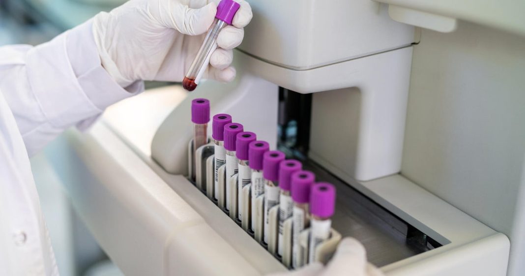FDA greenlights marketing of first Alzheimer's blood test for some patients